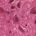 CDC rabies warning with wildlife safety guidance and medical caution